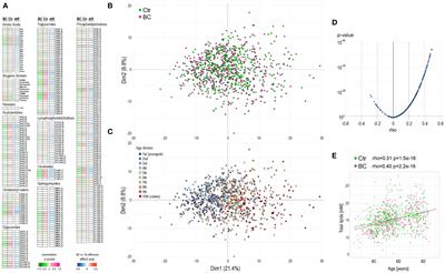Association of serum metabolome profile with the risk of breast cancer in participants of the HUNT2 study